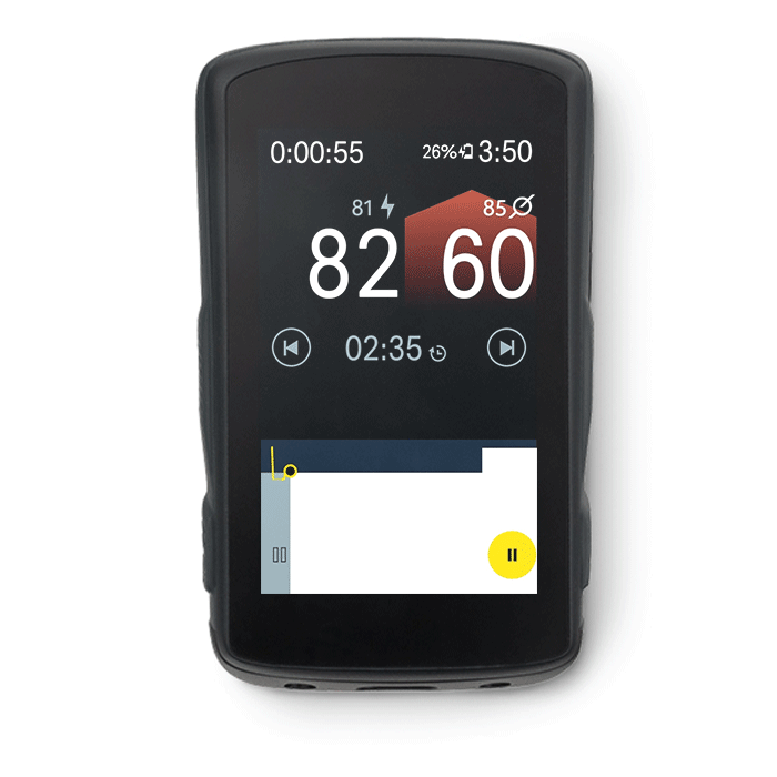 Skipping_Workout_intervals.gif